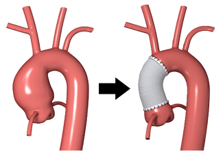 Aortic Center Jefferson Health